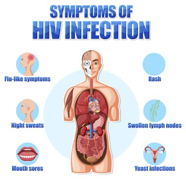 HIV illüstrasyonunun ana belirtilerinin bilgilendirici posteri