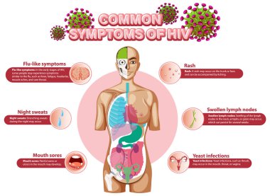 HIV illüstrasyonunun yaygın belirtilerinin bilgilendirici posteri
