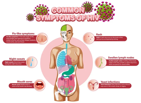 Cartaz Informativo Dos Sintomas Comuns Ilustração Hiv —  Vetores de Stock
