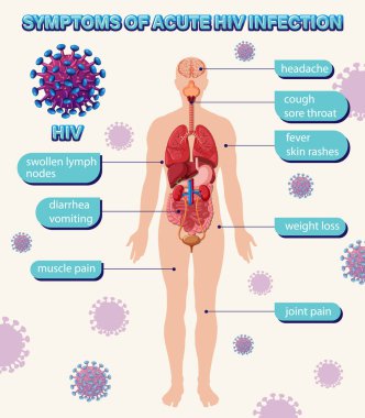 HIV illüstrasyonunun yaygın belirtilerinin bilgilendirici posteri