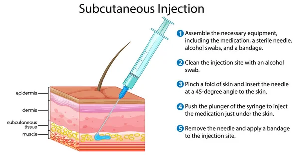 Subkutan Injektion Med Förklarande Illustration — Stock vektor