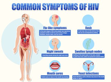 HIV illüstrasyonunun yaygın belirtilerinin bilgilendirici posteri
