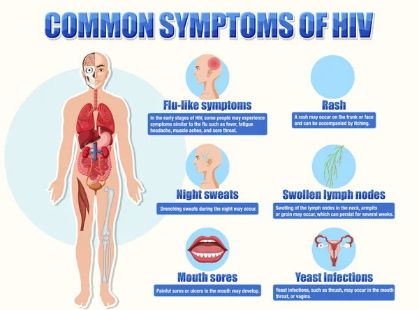 Hiv Illüstrasyonunun Yaygın Belirtilerinin Bilgilendirici Posteri — Stok Vektör