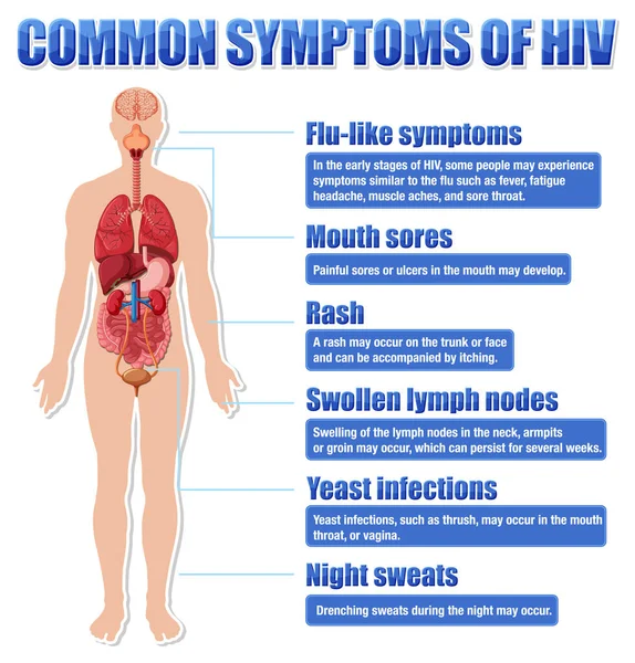 HIV illüstrasyonunun yaygın belirtilerinin bilgilendirici posteri