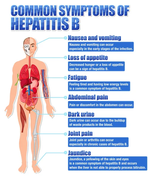 Cartaz Informativo Dos Sintomas Comuns Ilustração Hepatite — Vetor de Stock