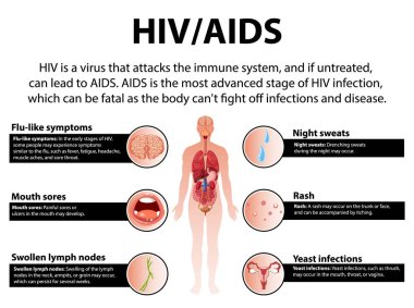 İllüstrasyon, HIV / AIDS 'in bağışıklık sistemi, beyin, ağız, deri ve semptomlar üzerindeki etkisini gösteriyor.