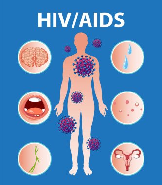 HIV / AIDS virüsünün bağışıklık sistemine nasıl saldırdığını ve beyin, ağız ve deriyi nasıl etkilediğini gösteren çizimler