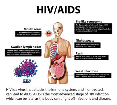 HIV / AIDS 'in vücut üzerindeki etkisini gösteren resimli bilgi