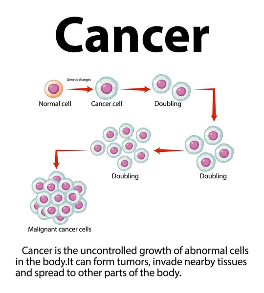 Ilustrowana Infografika Przedstawiająca Rozwój Przetwarzanie Komórek Nowotworowych — Wektor stockowy