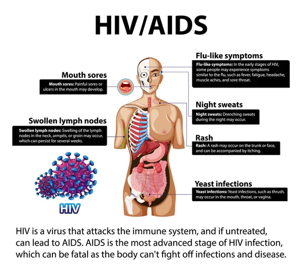 HIV / AIDS 'in vücut üzerindeki etkisini gösteren resimli bilgi