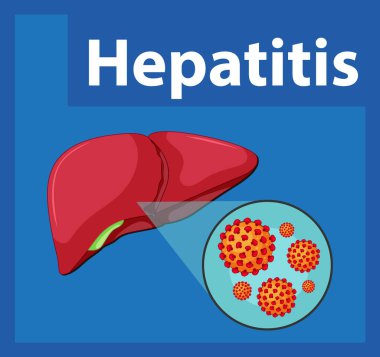 İnsan karaciğeri üzerinde hepatit virüsü hücresinin detaylı çizimi