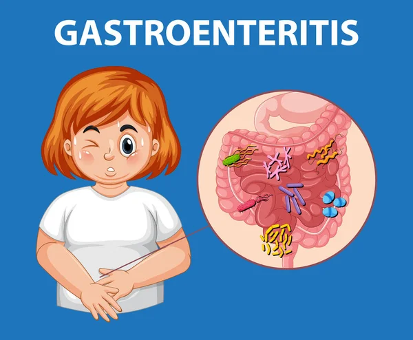 Illustration Woman Suffering Gastroenteritis Showcasing Symptoms Visual Format — Stock Vector