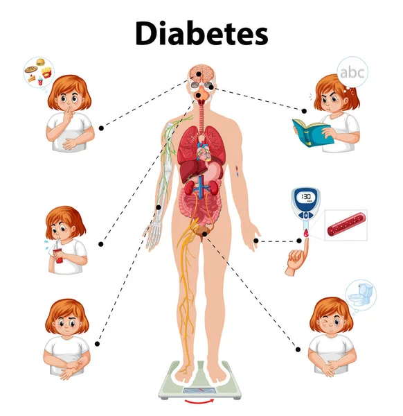 Infographic Illustrating Effects Diabetes Human Body Stock Vector by ...