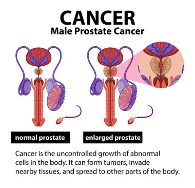 Normal ve anormal prostat hücre büyümesini karşılaştırma