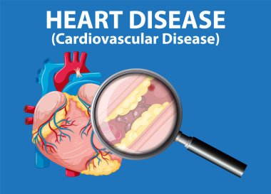 Tıbbi anatomideki hastalıkları ve kalp hastalıklarını vurgulayan resimli bilgiler