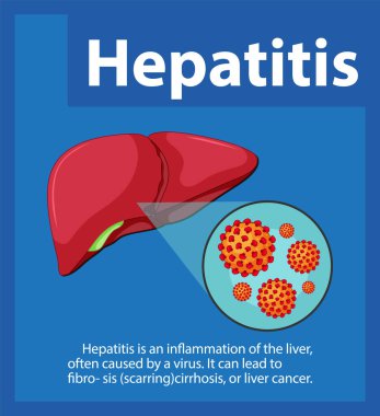 İnsan karaciğeri üzerinde hepatit virüsü hücresinin detaylı çizimi
