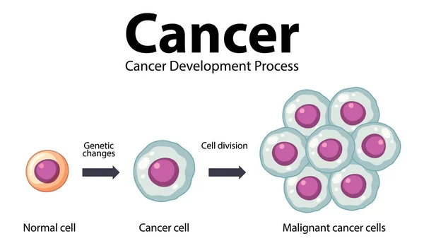 Illustrerad Infografik Som Visar Utvecklingen Och Bearbetningen Cancerceller — Stock vektor