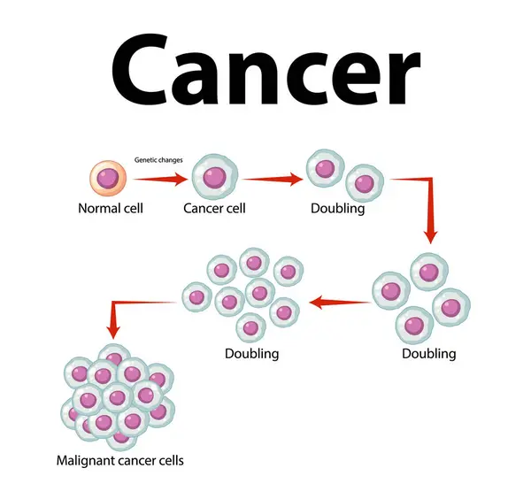 Inzicht Ontwikkeling Verwerking Van Kankercellen Door Middel Van Een Infographic — Stockvector