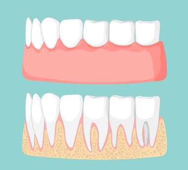 Diş yapısını ve sakız sağlığını gösteren vektör