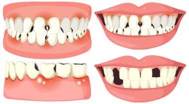 Çeşitli diş durumlarını ve tedavileri betimleyen vektör sanatı