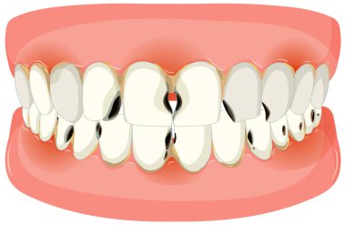 İnsan dişlerinin ve diş etlerinin vektör görüntüsü