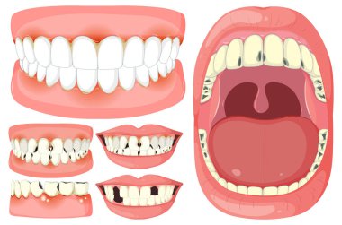 Çeşitli diş durumları ve tedavilerin vektör illüstrasyonu