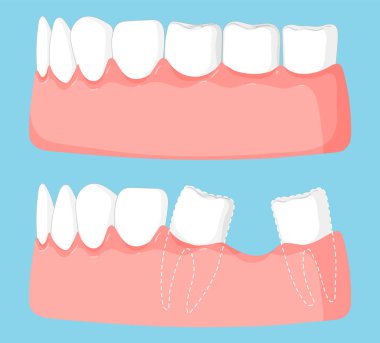Diş ve sakız sağlığı kavramlarını gösteren illüstrasyon