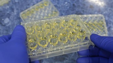 Bir bilim adamının ellerindeki bağışıklık plakasının yakın çekimi; levhanın kuyuları Escherichia coli 'nin sıvı kültürü içerir..