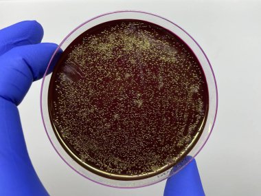 Escherichia coli kültürünün teşhisi için kırmızı ENDO ortamına sahip petri kabı.