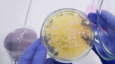 Bilim adamı çanağı açıyor, yakın plan. Sarı tarım kabındaki beyaz bakteri kolonileri laboratuarda inceleniyor..