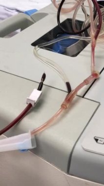 Kan trombosit bağışı makinesi işe yarıyor. Hastanede kan ve trombosit ayırmak için koldan kan alıyor..