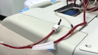 Kan trombosit bağışı makinesi işe yarıyor. Hastanede kan ve trombosit ayırmak için koldan kan alıyor..