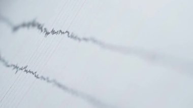 Elektroensefalogramı inceliyorum, EEG. Odaklanmayı ayarla