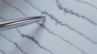 Elektroensefalogramı inceleyen doktor, hastanın beyin aktivitesini inceleyen, Eeg.