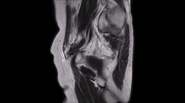 Pelvic MRI cross-section highlighting muscles, bones and surrounding soft tissues in a single axial slice. Useful for medical education, anatomy study, and healthcare  about pelvic anatomy.