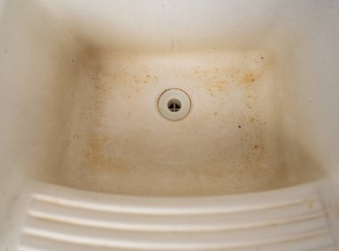 Sarı lekelerle kaplı beyaz bir lavabo yıllar süren ihmal ve suistimalden dolayı çıkmıyor..