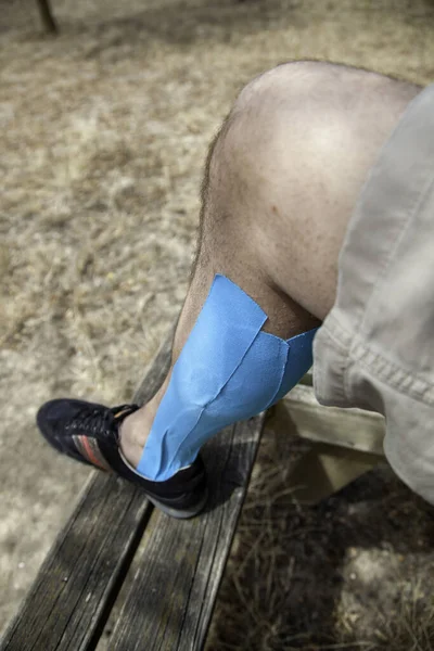 Detail of a leg injury of a young man, recovery