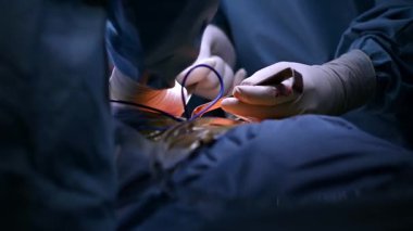 Steril bir ortamda becerikli ellerin ustalıkla sergilediği cerrahi bir operasyonun ayrıntılı bir yakın çekimi.