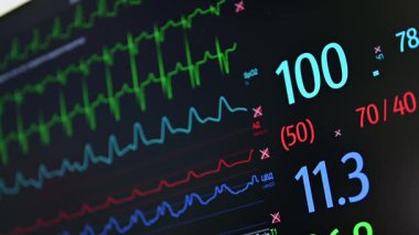 Yaşam belirtilerini ve ECG değerlerini klinik ortamda gösteren hasta monitörünün ayrıntılı görünümü.
