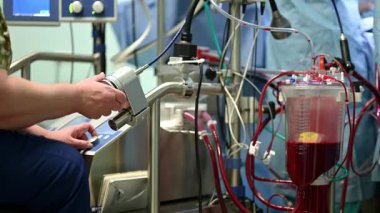 Cerrahi bir prosedür sırasında tıbbi makinelerin karmaşık bir görünümü, teknoloji ve hassasiyeti vurguluyor.