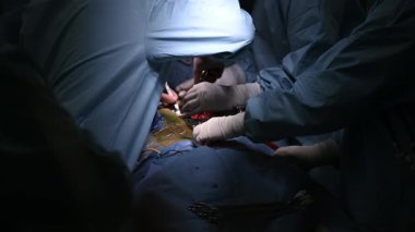 Cerrahlar, hassas ve odaklanmış aydınlatma koşulları altında karmaşık bir prosedür sırasında etkili bir şekilde işbirliği yapıyorlar.
