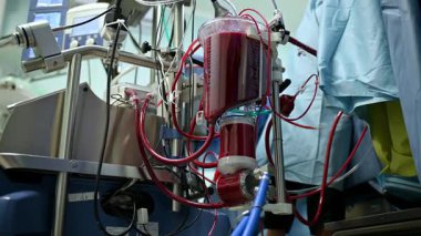 Hasta bakımı ve izleme için kullanılan karmaşık tıbbi ekipmanların detaylı bir yakın çekimi.