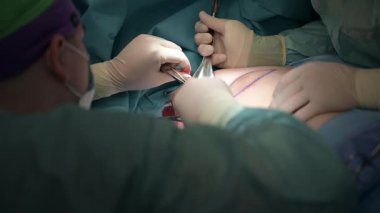 Karmaşık bir cerrahi prosedüre yakın çekim nitelikli profesyoneller tarafından kullanılan karmaşık teknikleri vurgular.