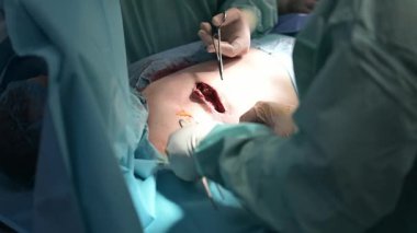 Cerrahlar titizlikle steril bir ortamda hassas bir ameliyat yapmaya çok odaklanmışlardı.