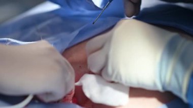 Görüntü, yetenekli elleri ve dikkate değer tıbbi uzmanlığı vurgulayan karmaşık bir ameliyatın yakın çekimini gösteriyor.