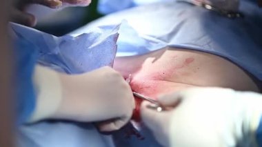 Bir cerrahi ekip klinik ortamda hassasiyet ve profesyonellik göstererek bir prosedür gerçekleştiriyor..