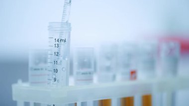 Laboratuvar ortamında yerleştirilmiş bir pipetle birlikte test tüpleri. Bilimsel araştırma görüntülerini göstermek için mükemmel.