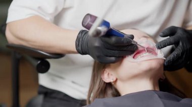 Diş kliniğinde diş temizliği, taşların ve plakların çıkarılması, tükürük emme. Yüksek kalite 4k görüntü