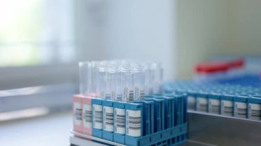 Modern bir laboratuarda yerleştirilmiş test tüpleri hassas ve güvenilir tıbbi testler gösteriyor.