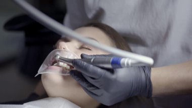 Profesyonel diş beyazlatma prosedürü. Yumuşak bir plaketten diş fırçalamak. Profesyonel diş temizliği, kadın hastalar güzel takma dişler. Enamel, özel bir fırça ve macunla cilalıyor. - Evet. Yüksek kaliteli FullHD görüntüler